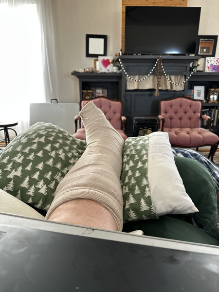 Photo of my leg in a cast.